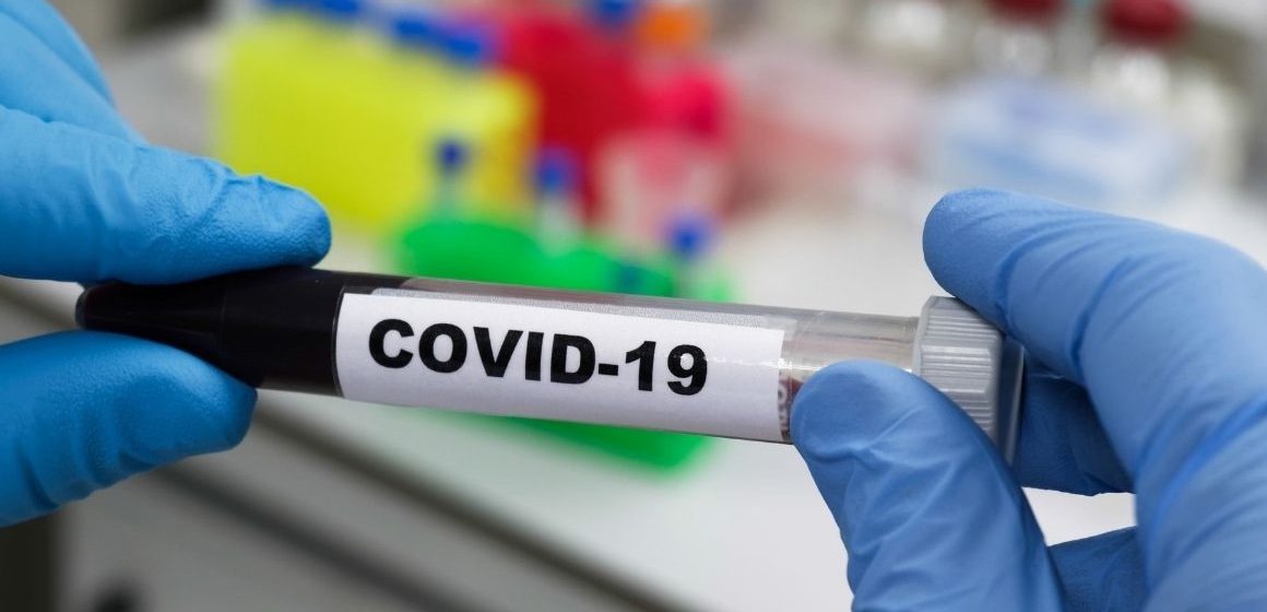 Covid Guidonia, 107 nuovi casi in una settimana